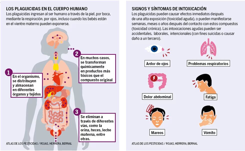 Infografía